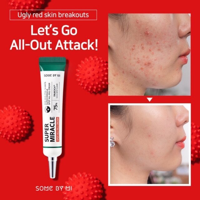 super miracle some by mi