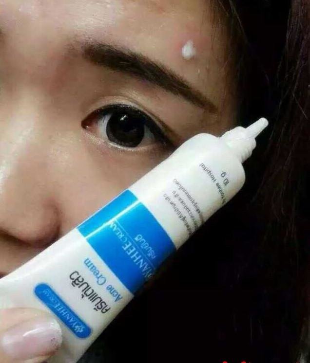 yanhee acne cream