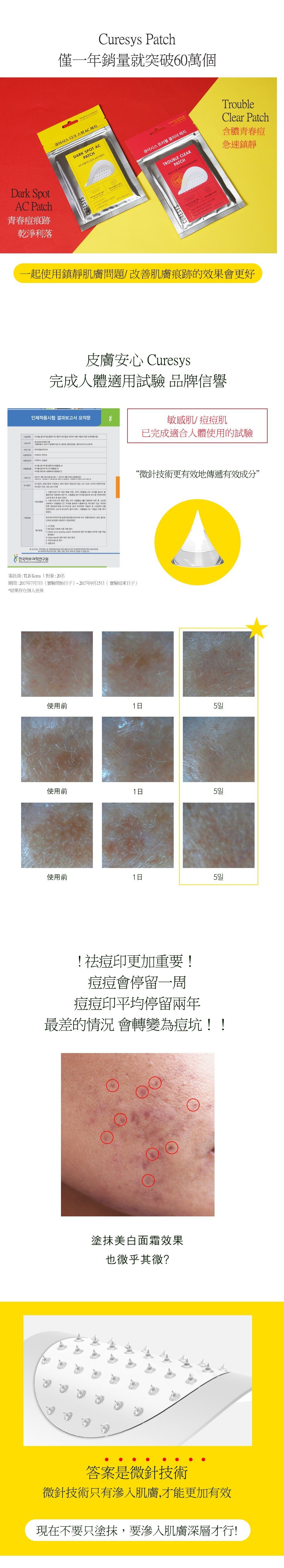 CURESYS | 微針淡斑去痘印貼(9片裝) [黃色包裝] | EESE 生活網上購物平台