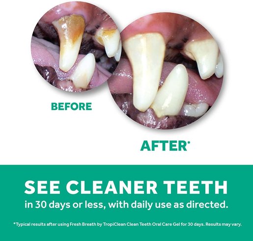 clean teeth gel